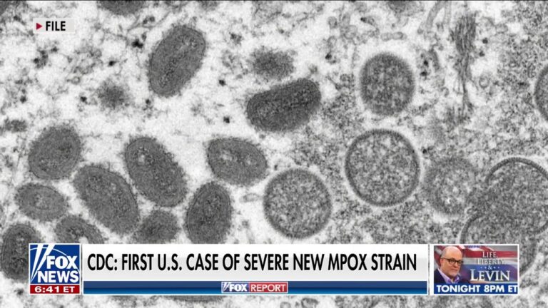 Doctor shares what people should know about a new mpox strain