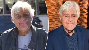 Jay Leno ‘feeling good’ despite suffering bruised face from fall