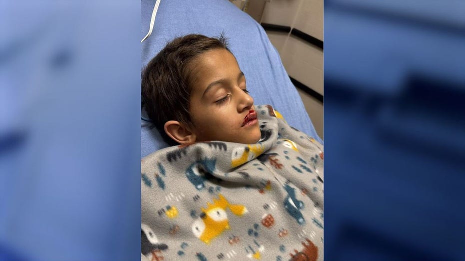 Florida boy has open heart surgery after being hit by drone at holiday show, parents say