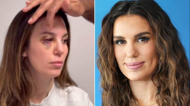 Christy Carlson Romano calls it a 'miracle' she isn't blind after bullet came within a millimeter of her eye