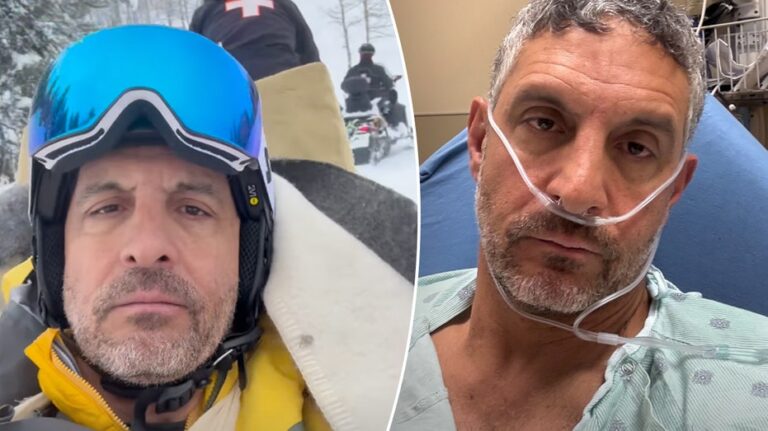 'Real Housewives' star Mauricio Umansky's emergency surgery required metal plate, 12 screws