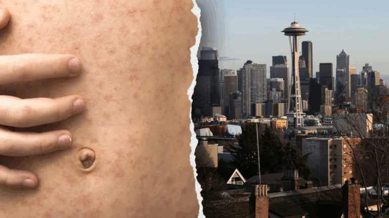 Officials in West Coast state sound alarm after traveler diagnosed with highly contagious viral disease