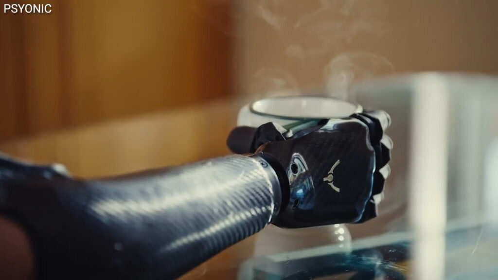 'CyberGuy': The world’s first touch-sensing bionic hand with lightning-fast response