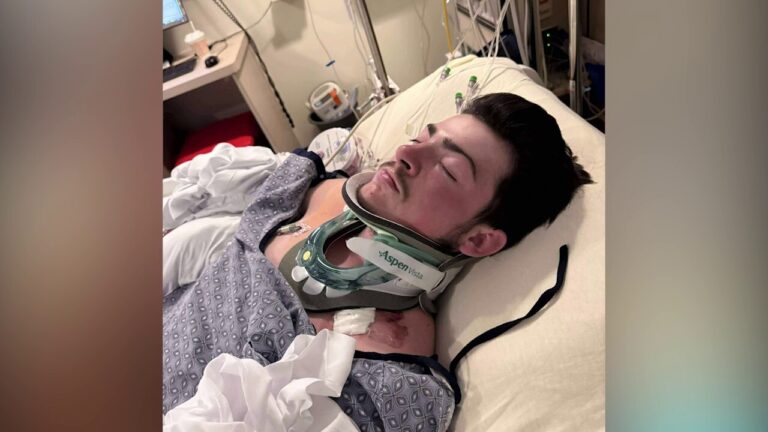 Mom says teenage son battling to recover after freak accident at beach