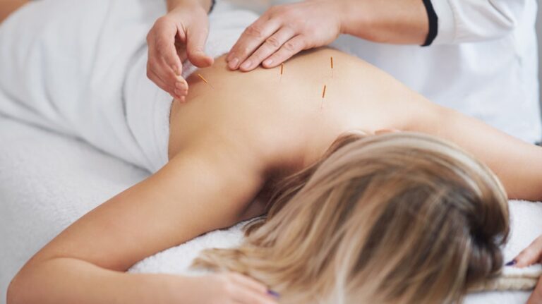 More people turn to acupuncture for back pain as study shows relief