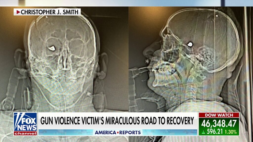 Inside a gun violence victim's miraculous survival
