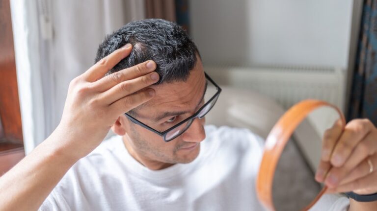 New baldness treatment shows dramatic hair-regrowth gains in major trial