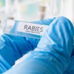 11-year-old dies from rabies after bat landed on his face while he was sleeping